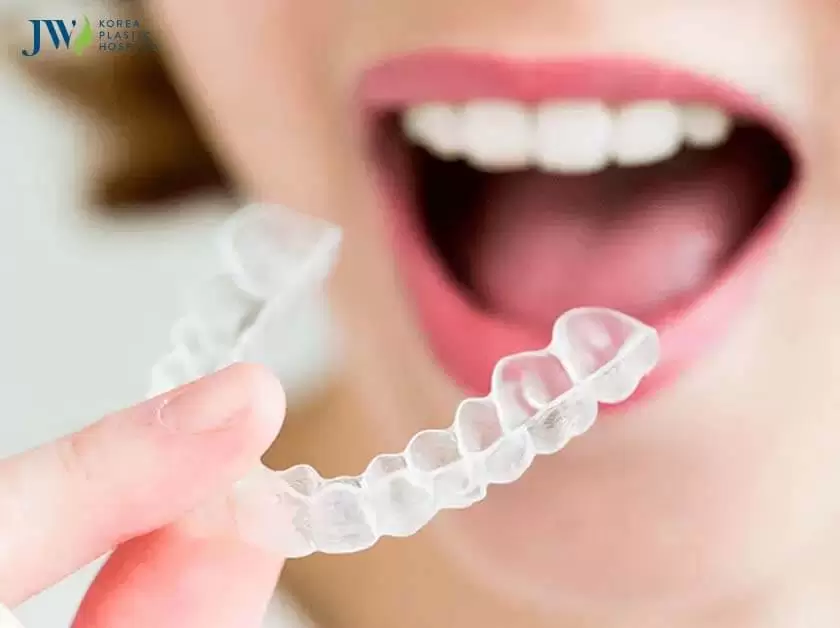 Niềng răng trong suốt AI dành cho trẻ em