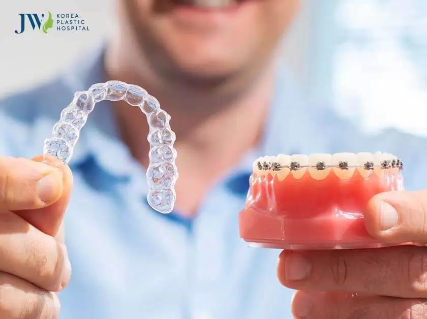 Niềng răng trong suốt AI tốt hơn
