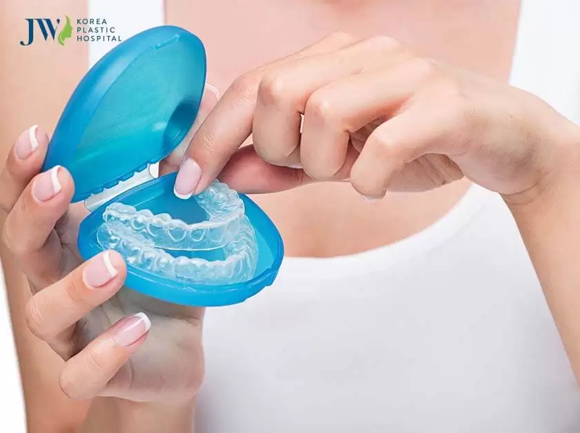 thời gian niềng răng trong suốt AI