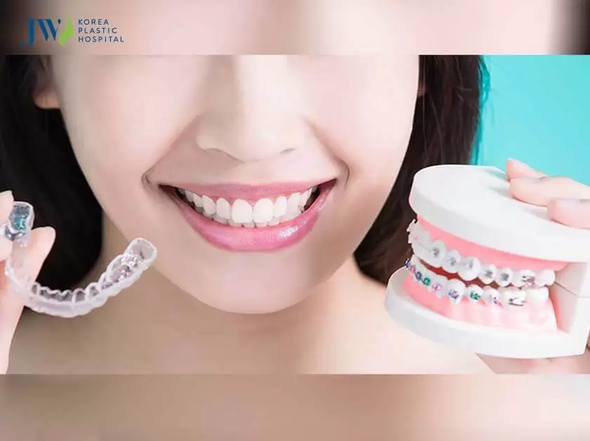 Niềng răng trong suốt AI nhẹ nhàng hơn