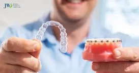 Niềng răng trong suốt AI tốt hơn