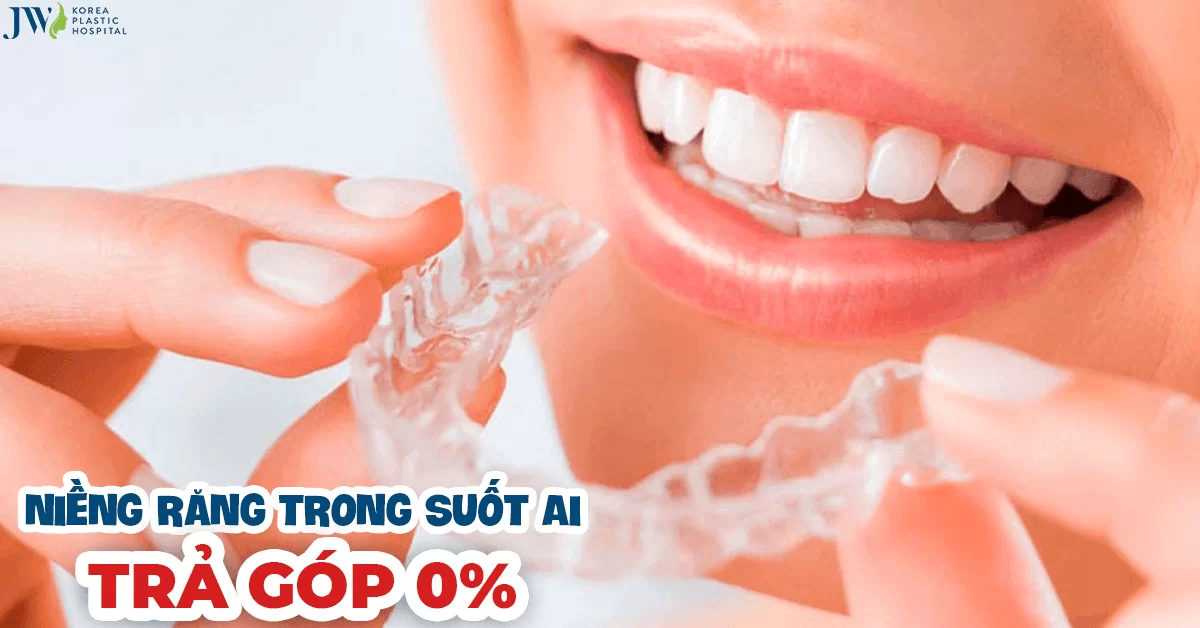 Niềng răng trả góp được không? Thủ tục tại JW thế nào?