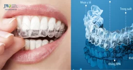 quy trình niềng răng trong suốt