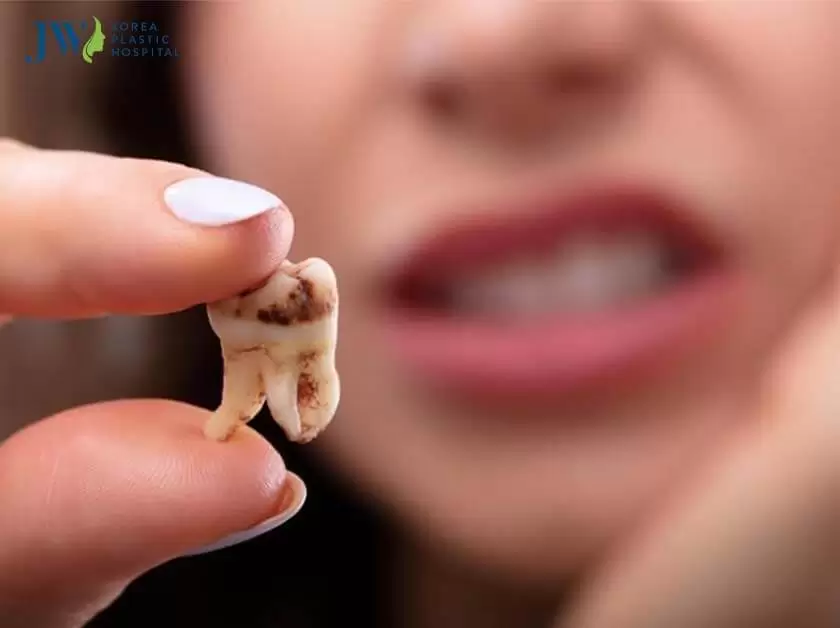 răng chết tủy có niềng được không?