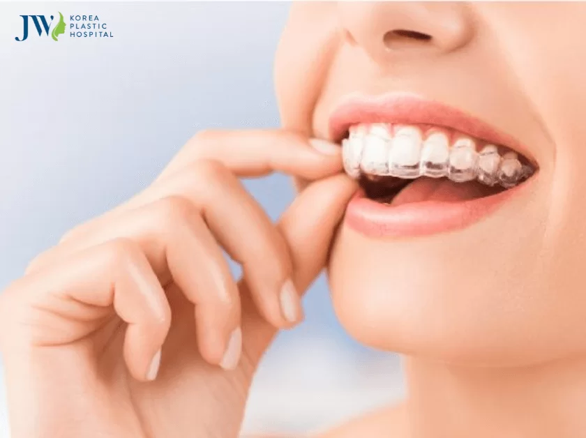 răng yếu có niềng răng được không