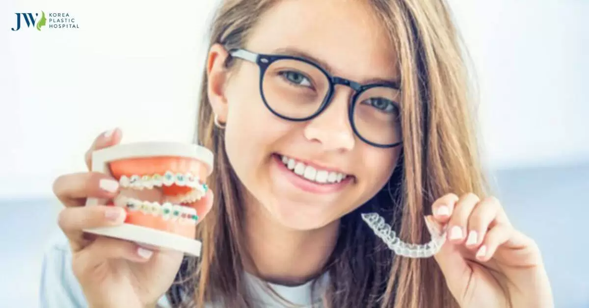 Niềng răng trong suốt AI hay mắc cài và sự khác nhau