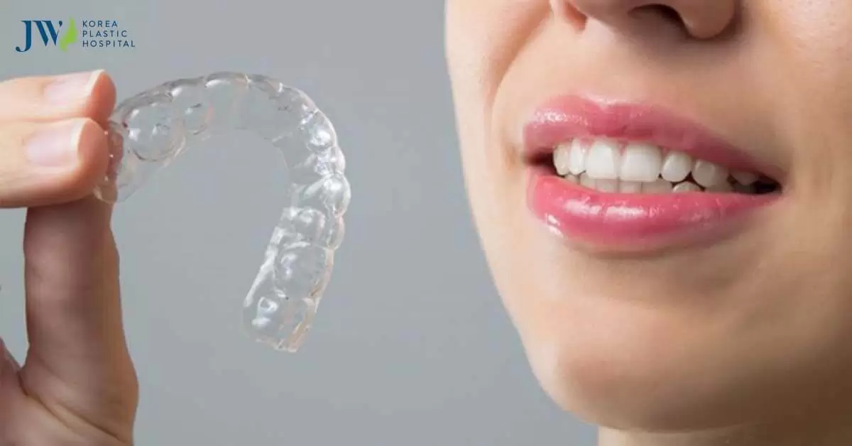 Thời gian niềng răng trong suốt AI bao lâu? Bệnh viện JW giải đáp