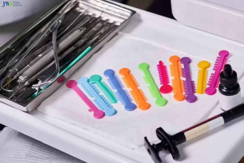 Các loại thun niềng răng phổ biến và tính năng của chúng 1