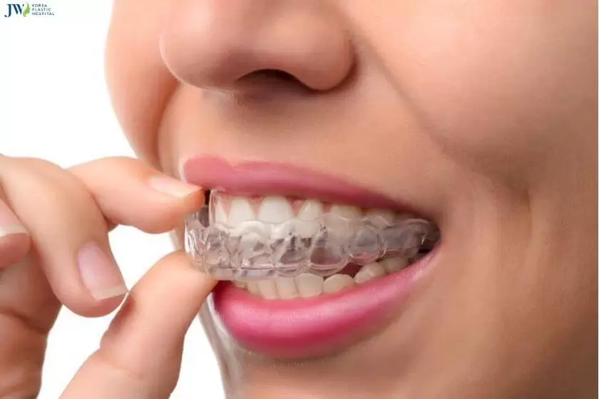 Hàm duy trì tháo lắp bằng khay trong suốt