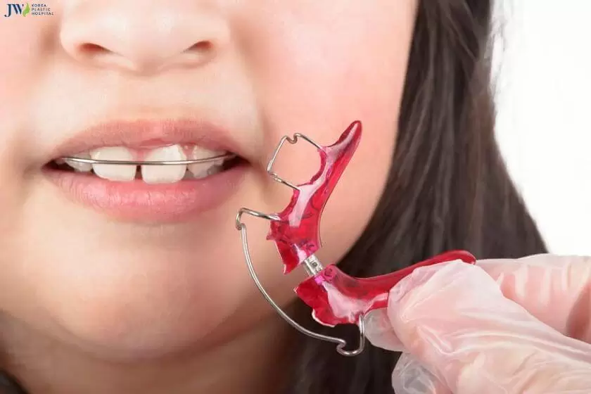 Hàm duy trì tháo lắp kim loại