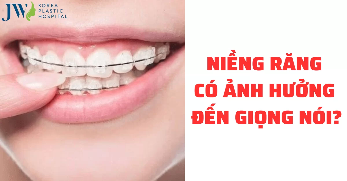 Quá trình niềng răng ảnh hưởng đến phát âm hay không?