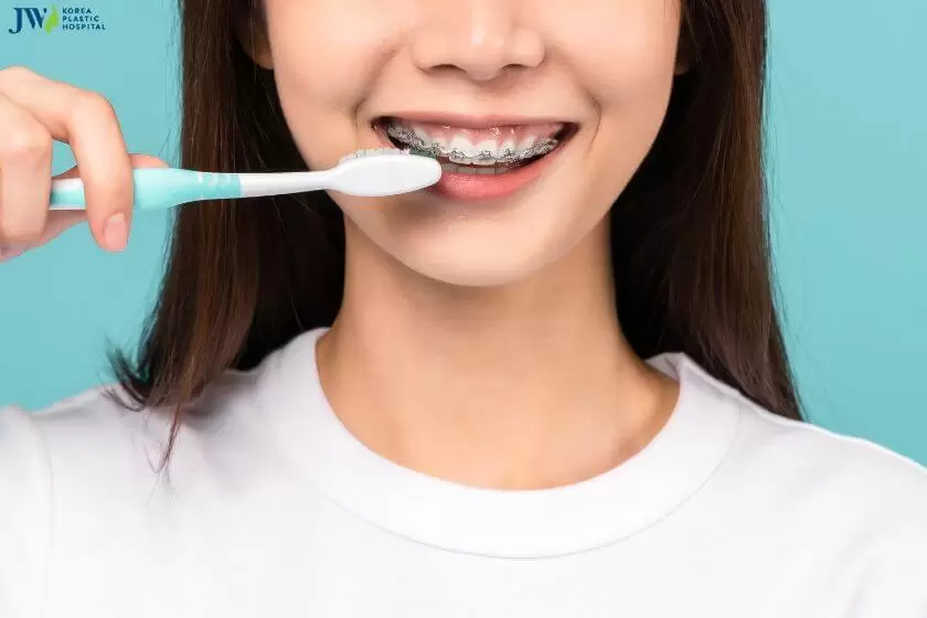 Niềng răng có gây ê buốt răng không? 3