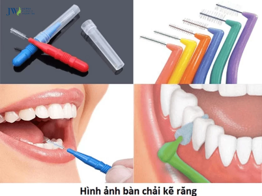 Bàn chải cho niềng răng
