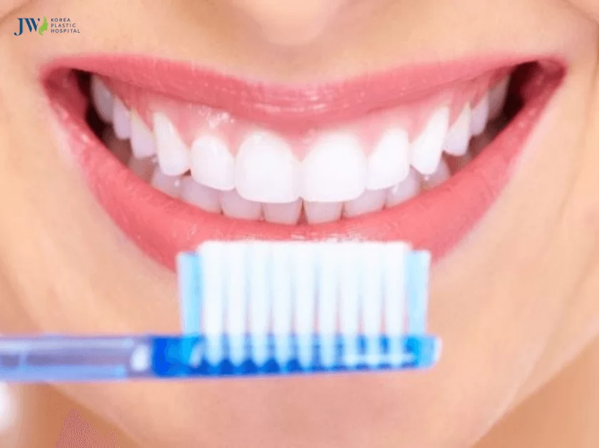 niềng răng xong vẫn hô