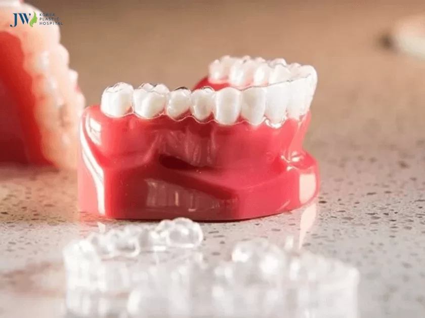 Niềng răng 3D Clear và niềng răng trong suốt AI