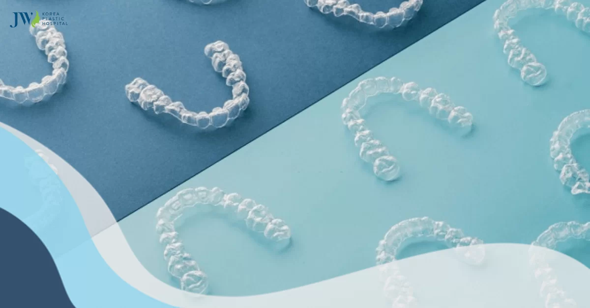 SO SÁNH: Niềng răng 3D Clear và niềng răng trong suốt AI