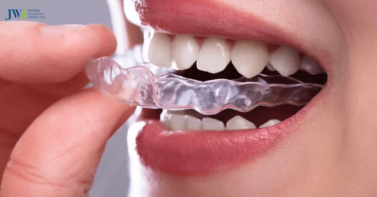 Niềng Răng Trong Suốt AI Tại Nhà Có Tốt Như Bạn Nghỉ Không?