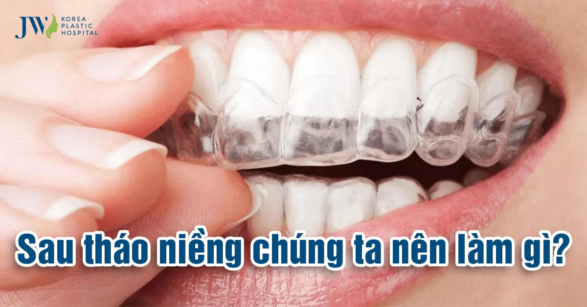 Sau Tháo Niềng Nên Làm Gì? Tổng Hợp Một Số Lưu Ý