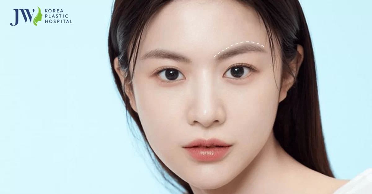 Treo chân mày – Trẻ hóa đôi mắt toàn diện chỉ sau 45 phút