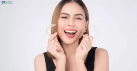 10 câu hỏi bạn cần trả lời trước khi quyết định niềng răng!