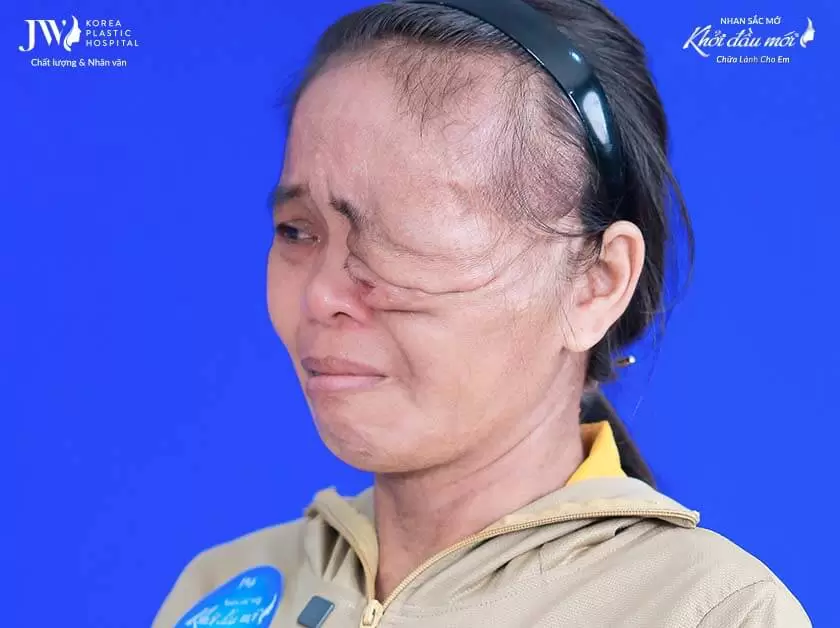 Nhan sắc mới - khởi đầu mới 