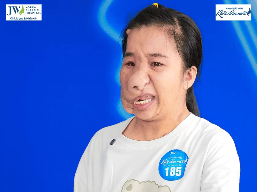 Nhan sắc mới - Khởi đầu mới 