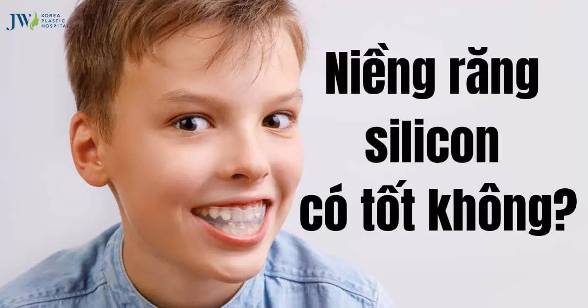 Niềng răng silicon có hiệu quả không? Một số lưu ý nên biết