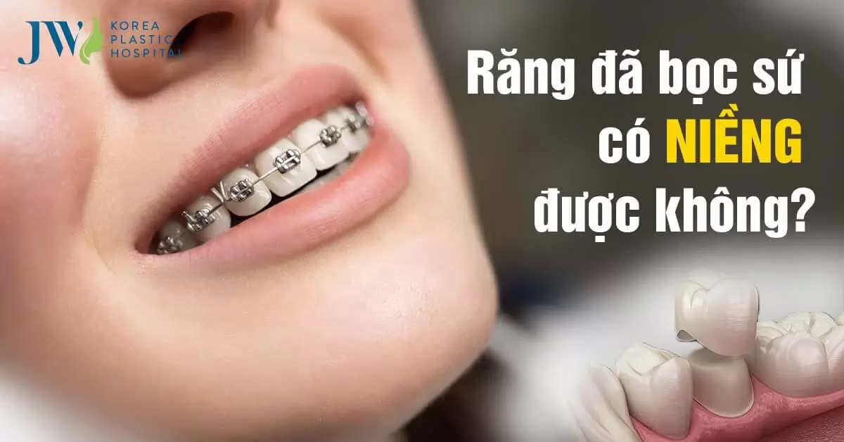 Răng đã bọc sứ có niềng được không?
