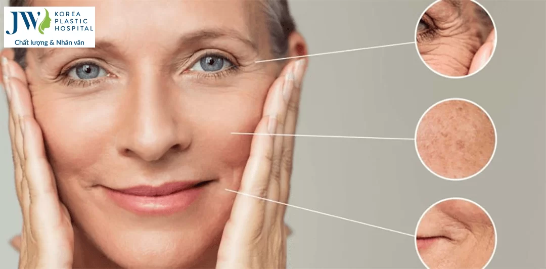 công nghệ Thermage