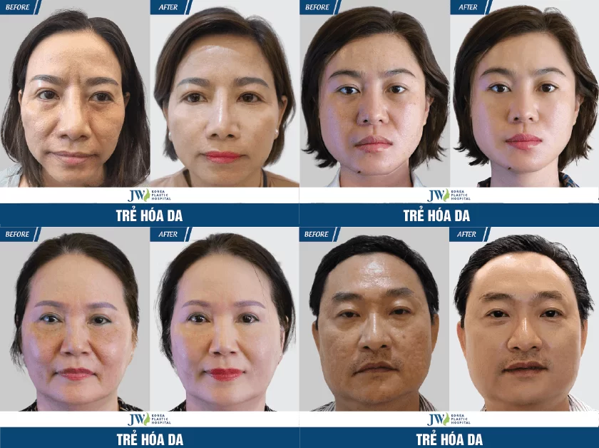 Công nghệ 3S PLUS