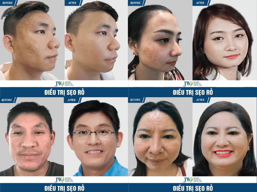 Công nghệ 3S PLUS