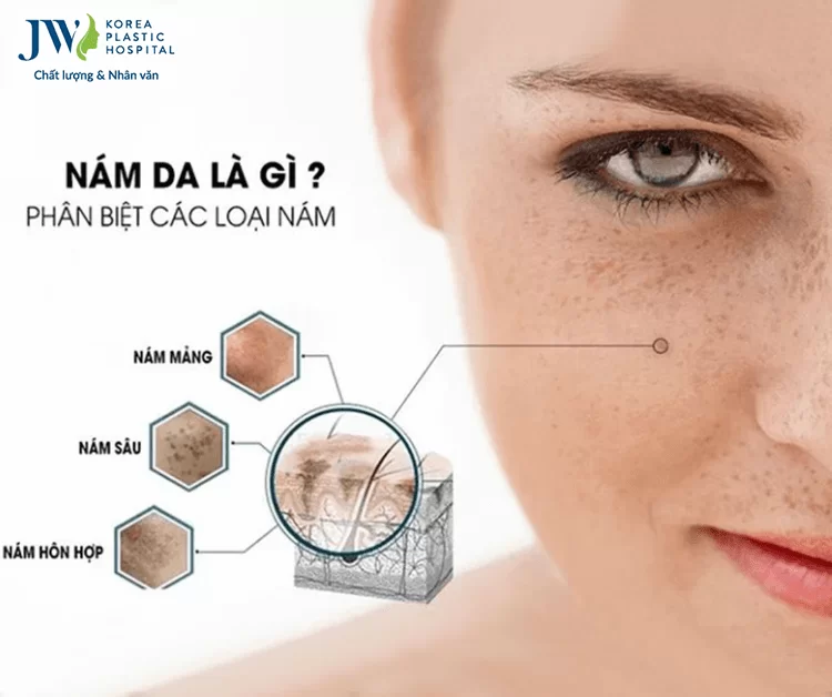 Công nghệ 3S PLUS