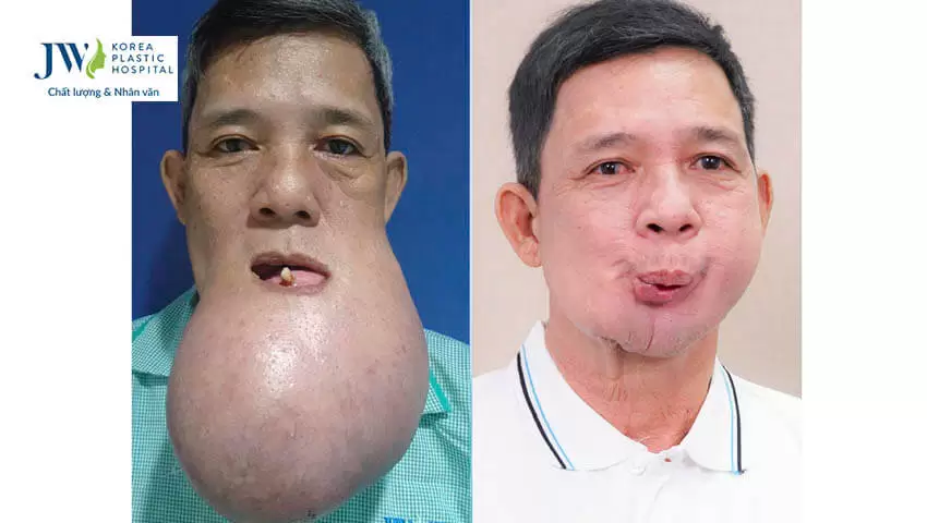 Bác sĩ Tú Dung