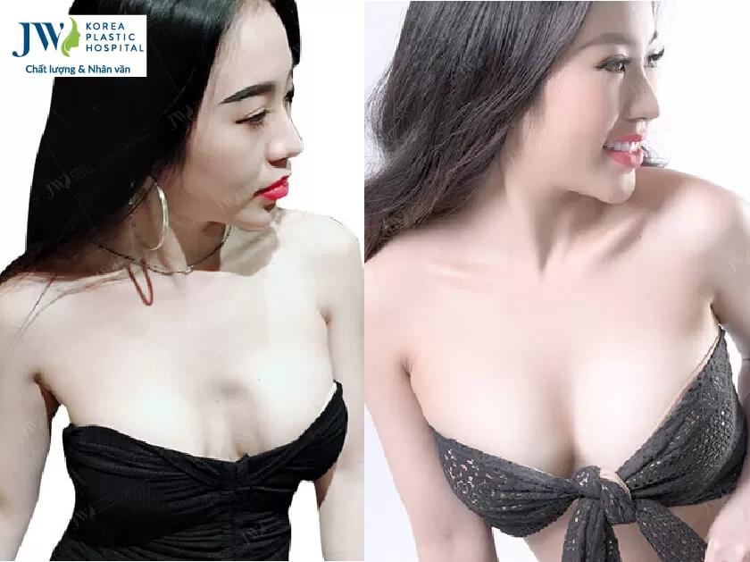 Dj-Nhung-nang-nguc-bi-loi
