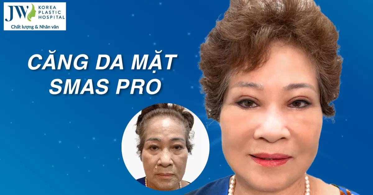 Căng da mặt SMAS PRO: Công nghệ diệu kỳ, giữ mãi nét xuân