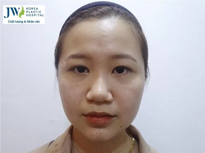Thiên Kim