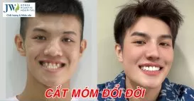 hàm móm