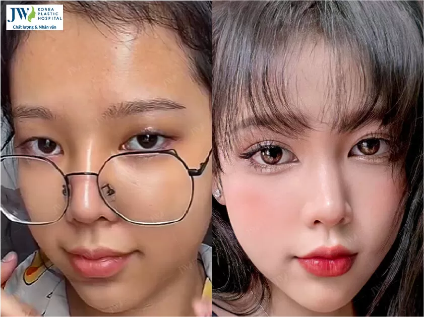 Phẫu thuật thẩm mỹ