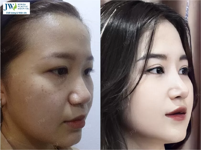 Phẫu thuật thẩm mỹ