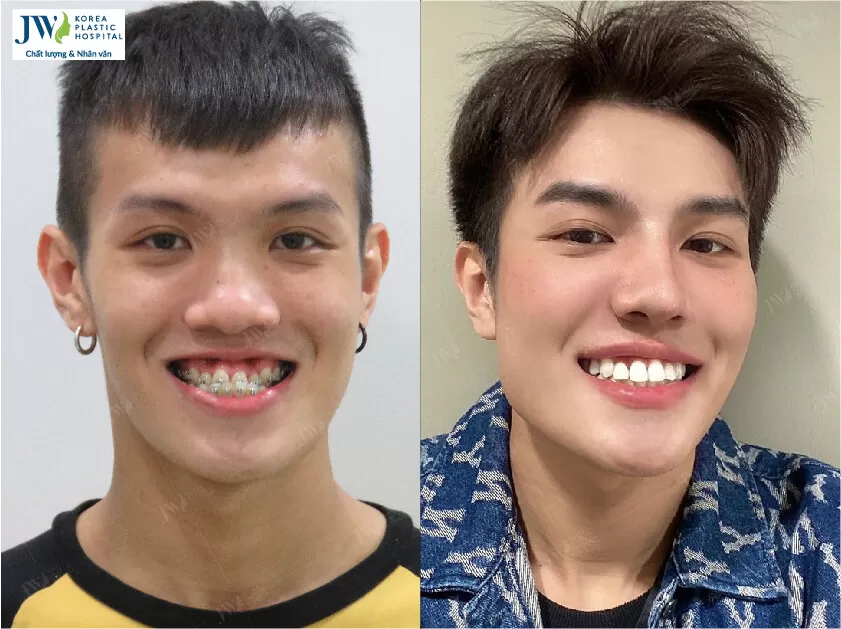 Phẫu thuật thẩm mỹ