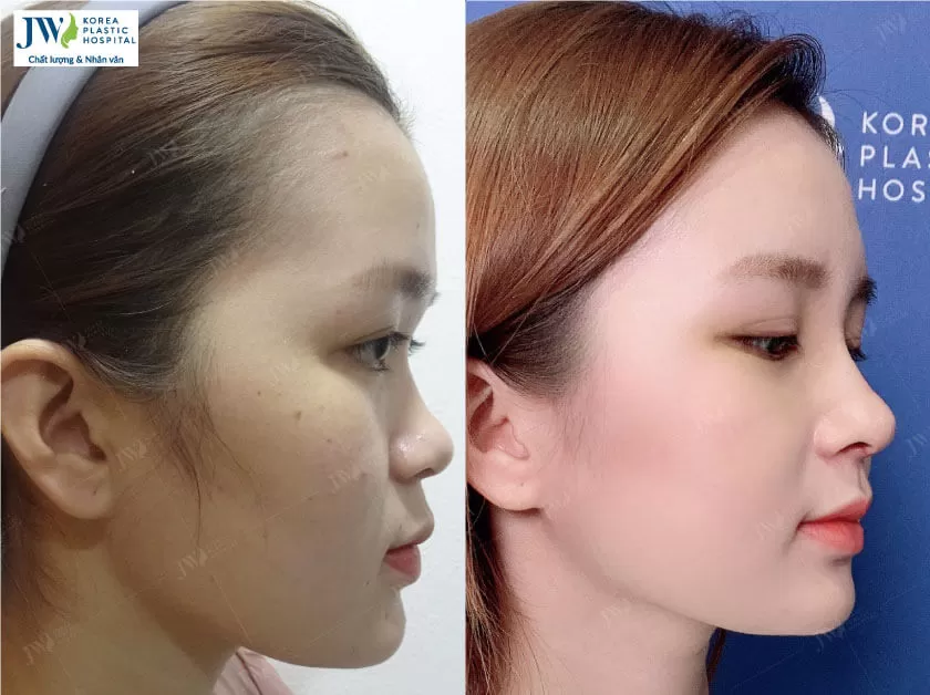 Phẫu thuật thẩm mỹ