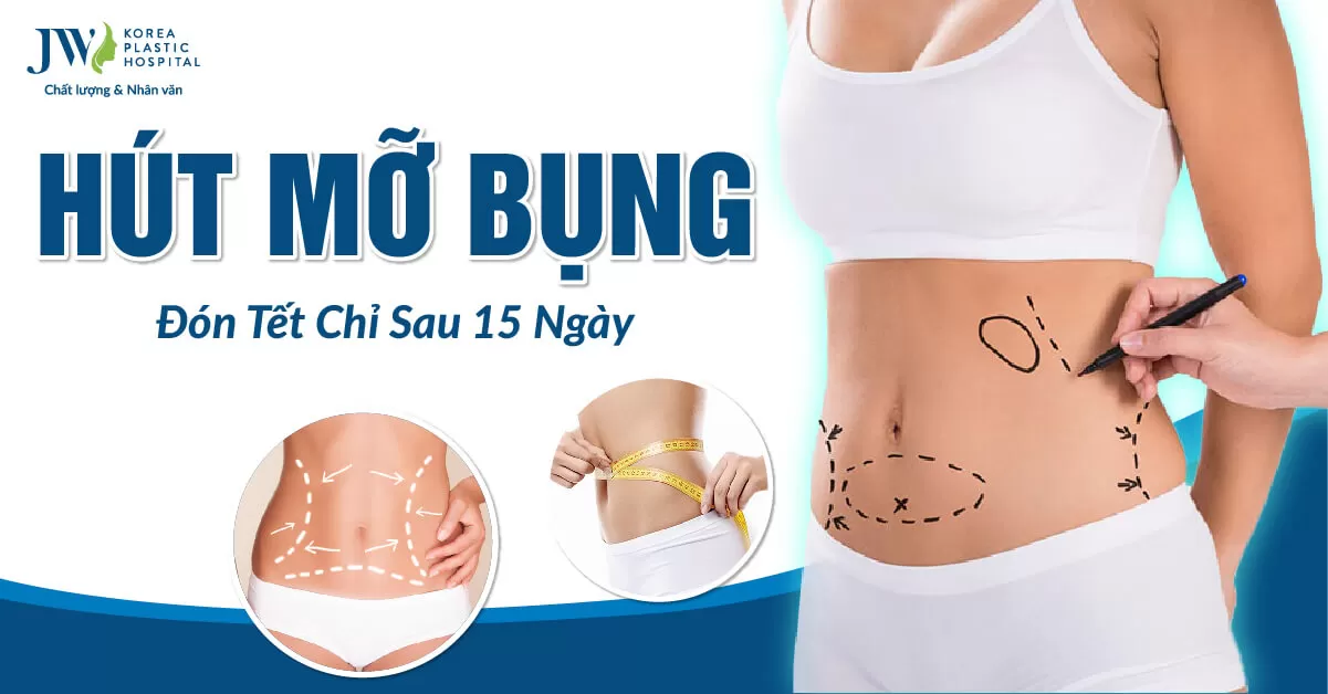 Hút mỡ bụng đón tết, bí quyết có vòng eo 58 chỉ sau 15 ngày