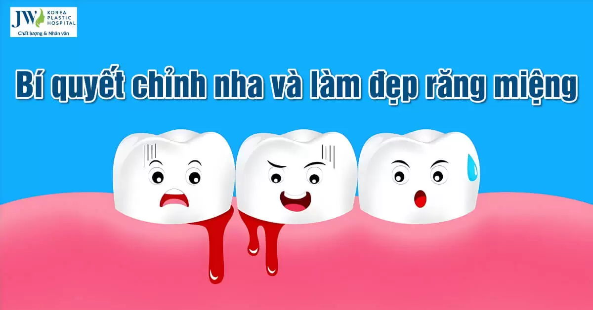 Bí quyết chỉnh nha và làm đẹp răng miệng dịp cuối năm