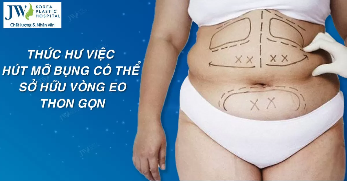 Thực hư hút mỡ bụng giảm được 15-20cm vòng eo
