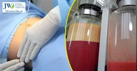 Hút mỡ có thể giảm bao nhiêu kg cân nặng