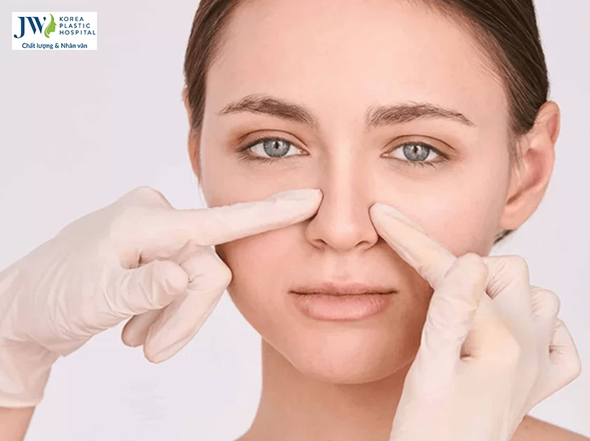 Nâng mũi bị hỏng biến dạng – Nỗi lo sợ kinh hoàng khi làm đẹp
