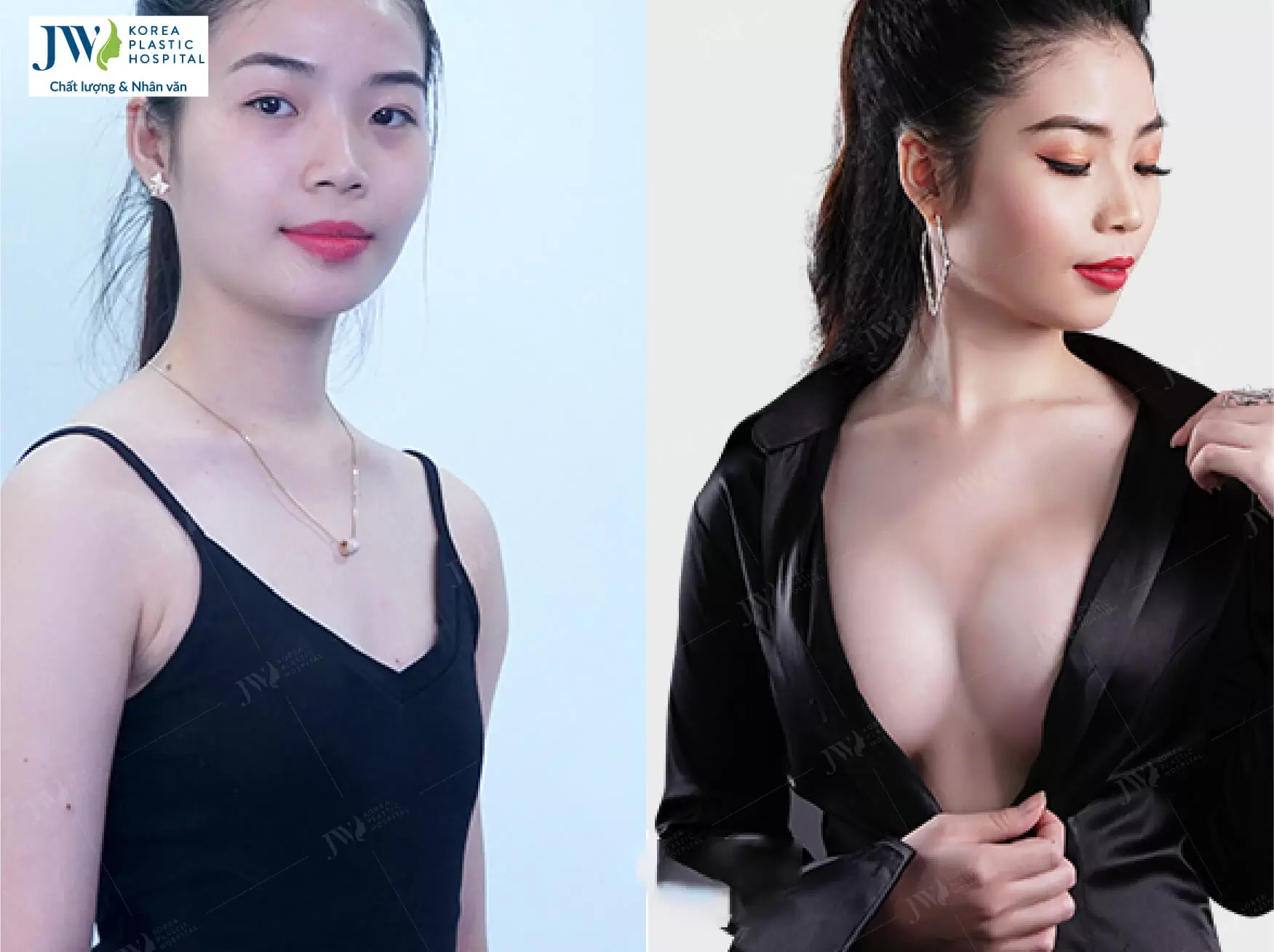 nang nguc noi soi jw 1