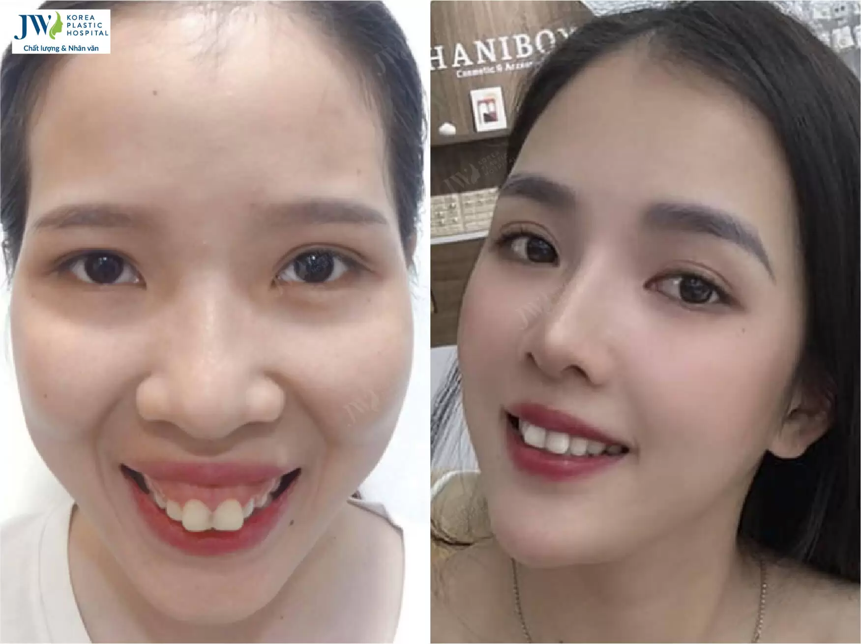 phẫu thuật thẩm mỹ
