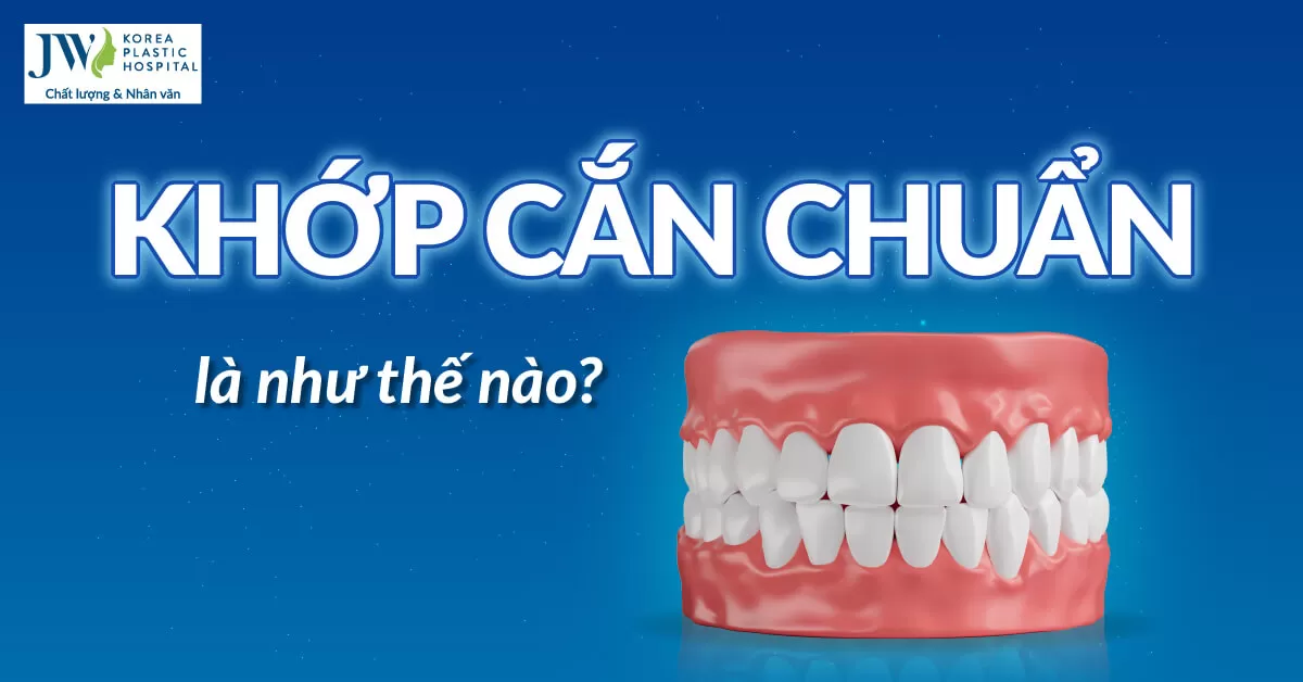 Khớp cắn chuẩn là như thế nào? Cách để có khớp cắn chuẩn