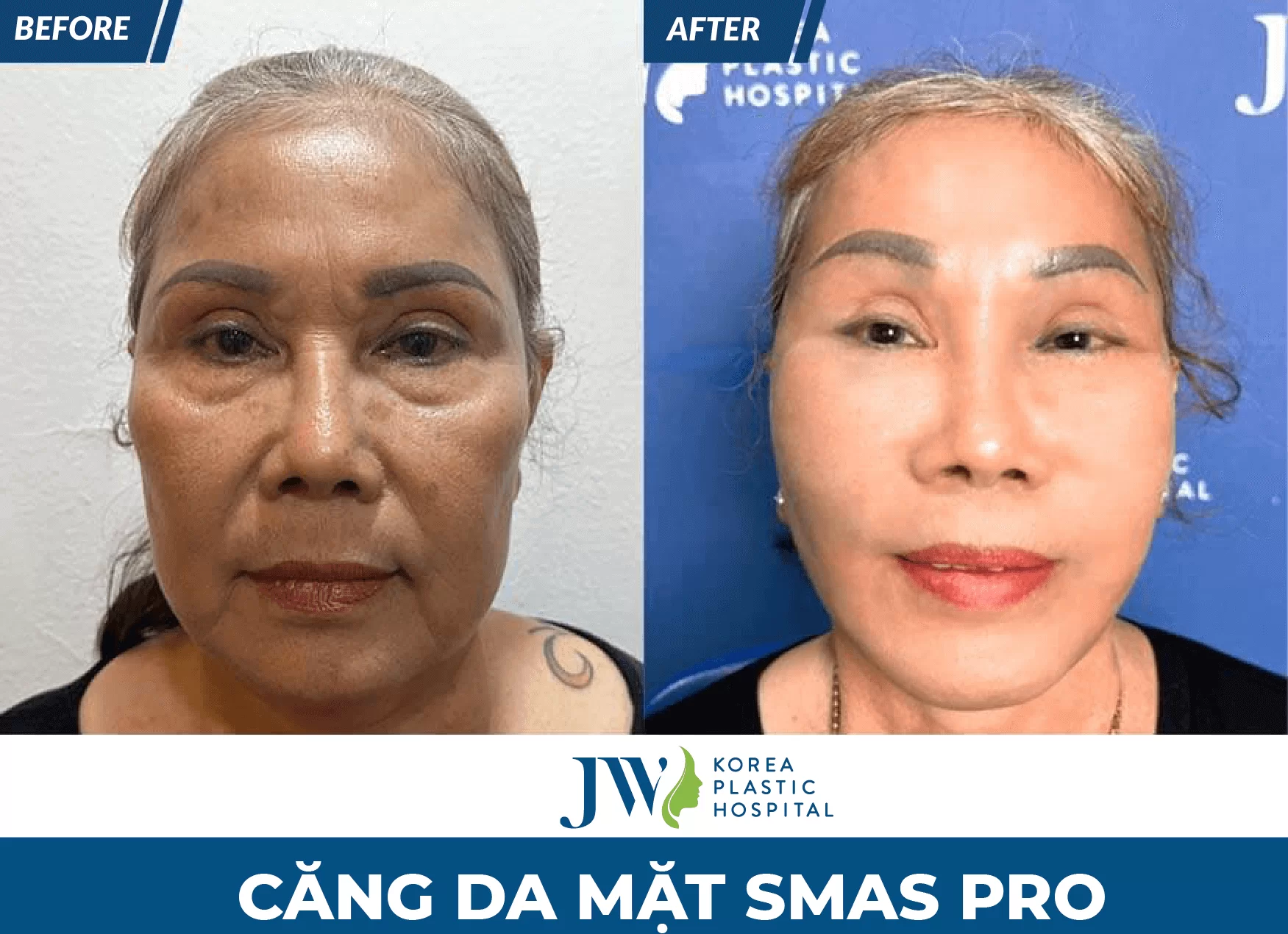 bệnh viện thẩm mỹ